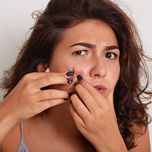Acne/Pimples Treatmeant