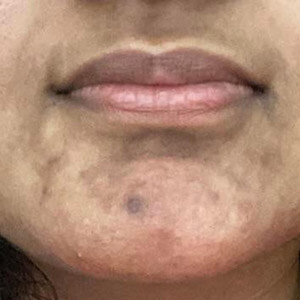 Brightening Solution